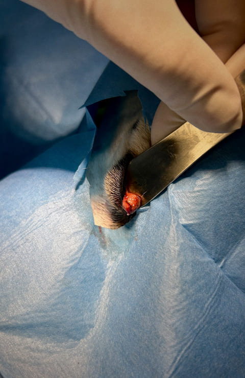 tumor en las glándulas de Meibomio en Hugo: cirugía