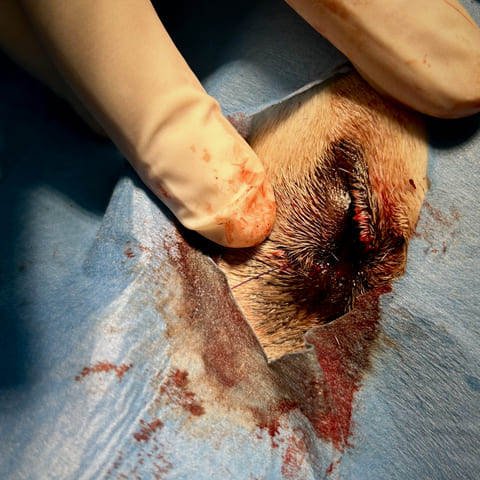 tumor en las glándulas de Meibomio en Hugo: fotos diagnóstico